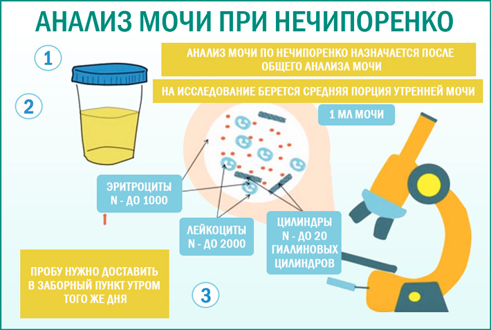 Анализ мочи по Нечипоренко